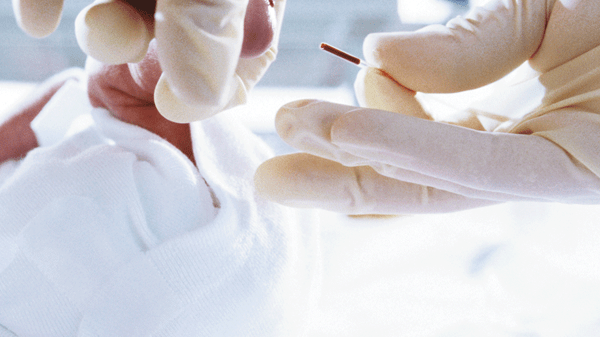 Image of a Clinitube capillary tube in use