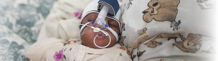 NICU point-of-care testing solution from Radiometer